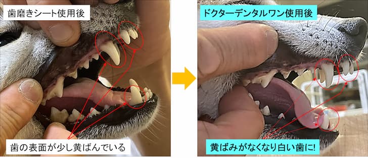 ドクターデンタルワン_before_after